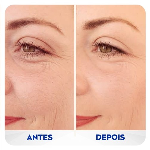 NIVEA PREENCHEDOR Q10 EXPERT ANTISSINAIS 15ML